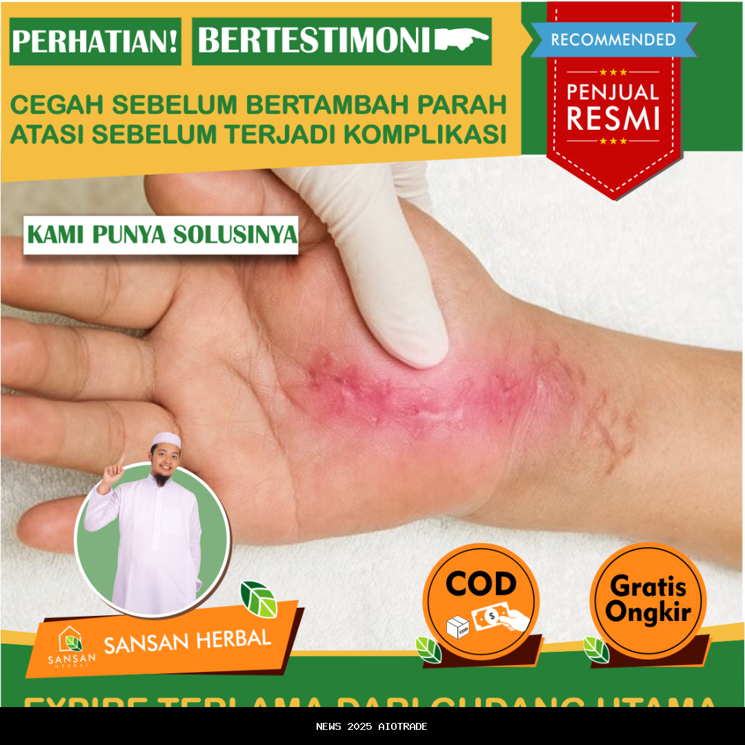 Tanaman Herbal dengan Khasiat Pereda Nyeri Alami