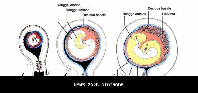 Kehamilan yang tidak direncanakan masih menjadi penghalang di Namibia - UNFPA