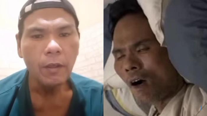 2 Minggu Tidak Makan Nasi, Kesehatan Fahmi Bo Memburuk, Kini Butuh Alat Bantu Napas